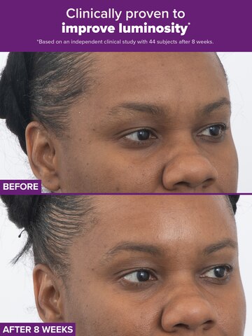 CLINICAL PRO Retinaldehyde Dual-Retinoid Treatment | Paula's